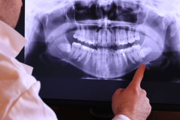 Best Weekend Emergency Dentist in Burnet, TX