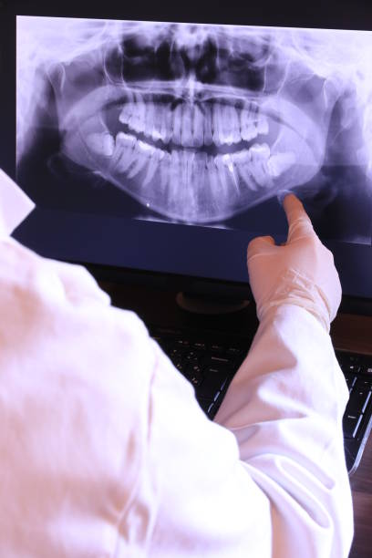 Best Emergency Dental Extractions in Burnet, TX