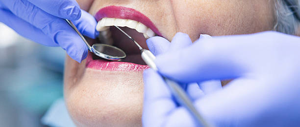 Best Emergency Dental Services for Seniors in Burnet, TX